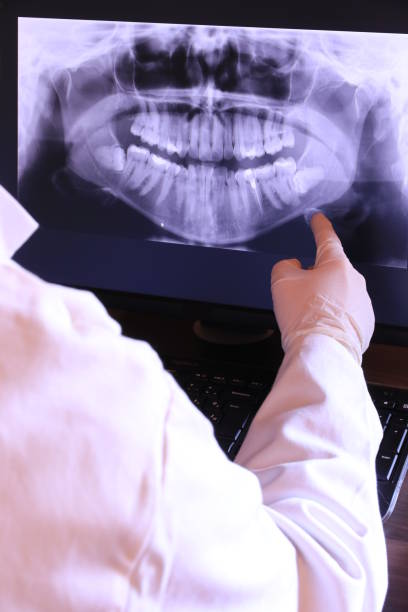 Best Emergency Dentist for Lost Fillings or Crowns in North Muskegon, MI